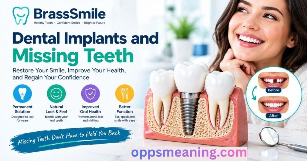 Dental Implants and Missing Teeth